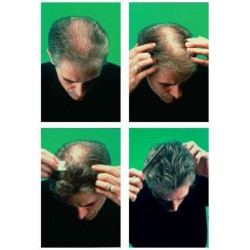 Ecobell Alopecia Lozione Mascherante Fluido Correttore (50ml)