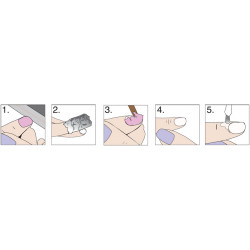 Red Carpet Kit Remove